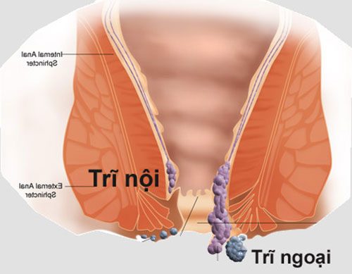 phan-biet-cac-loai-benh-tri-va-cach-phong-ngua-1