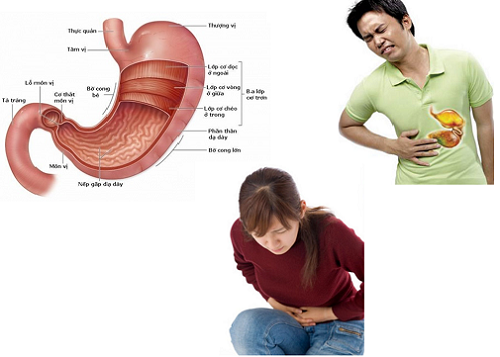 Viêm đại tràng mạn tính là quá trình viêm nhiễm gây tổn thương khu trú hoặc lan toả ở niêm mạc đại tràng với các mức độ khác nhau