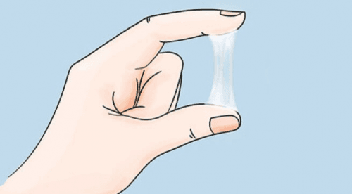 Huyết trắng ra nhiều có thể là do huyết trắng sinh lý, cũng có thể là huyết trắng bệnh lý
