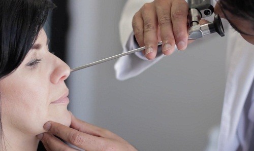 Phẫu thuật vẹo vách ngăn mũi là phương pháp điều trị được áp dụng để chỉnh sửa lại vách ngăn, giúp cải thiện luồng không khí lưu thông trong mũi. 