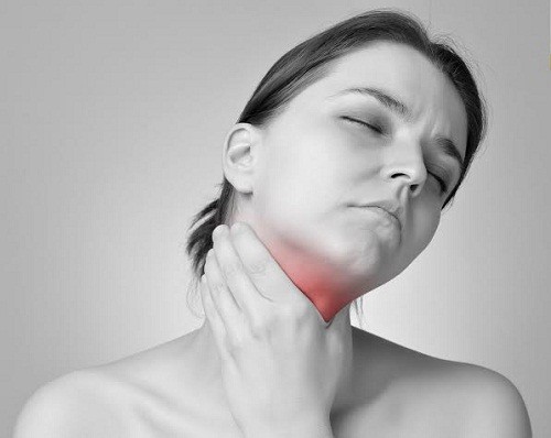 Bệnh thường xuất hiện sau amidan cấp khoảng 5-7 ngày với các triệu chứng đau họng