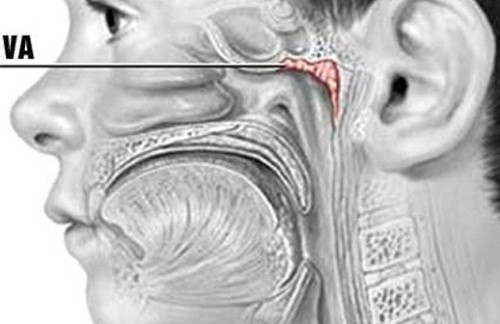 VA là một tổ chức lympho nằm ở vòm mũi họng gần cửa mũi sau thuộc vòng bạch huyết .