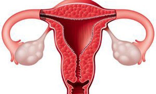 Mắc một số bệnh ở tử cung bẩm sinh hoặc do bệnh lý cũng gây ảnh hưởng tới khả năng sinh sản của chị em