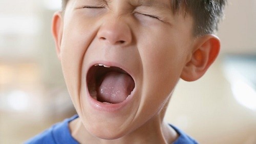 Trẻ em bị khàn tiếng do nhiều nguyên nhân như thường xuyên la hét, nô đùa, sử dụng tiếng nói quá nhiều
