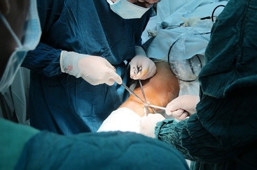 Phẫu thuật tạo hình dây chằng chéo khớp gối là phương pháp điều trị chính khi bị bệnh