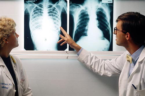 Có nhiều người khi chụp phim phổi tình cờ phát hiện có tổn thương xơ, di chứng của bệnh lao phổi trước đó đã tự khỏi.