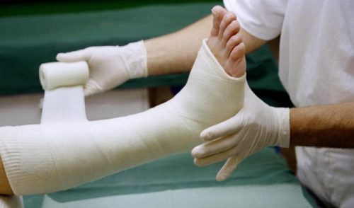 những bước sơ cứu khi gãy xương