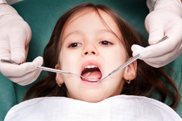 Trẻ em tiếp xúc với quá nhiều florua có thể có đường trắng hoặc nâu trên bề mặt răng.