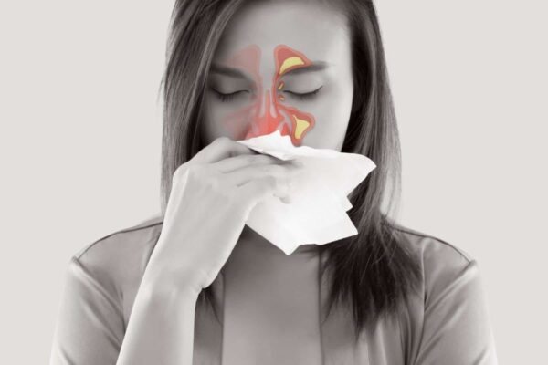 Biến chứng của bệnh viêm xoang ở tai mũi họng