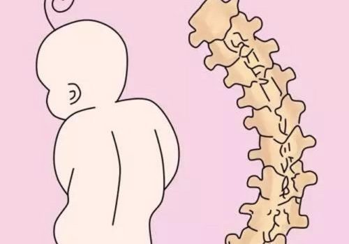 Nguyên nhân gây bệnh Viêm Cơ Khớp mà mọi người thường không để ý 1 Làm việc không đúng tư thế gây bệnh viêm cơ khớp