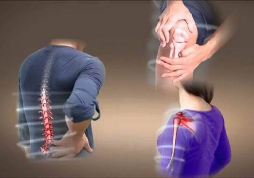 Viêm Cơ Cốt Hóa: Nguyên nhân, triệu chứng và Cách điều trị hiệu quả 1 Viêm cơ cốt hóa là sự hình thành dạng xương trong cơ, là một rối loạn hiếm gặp liên quan đến quá trình canxi hóa bất thường ở mô mềm.