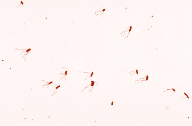 Ho gà phát sinh do trực khuẩn gram âm Bordetella. pertussis