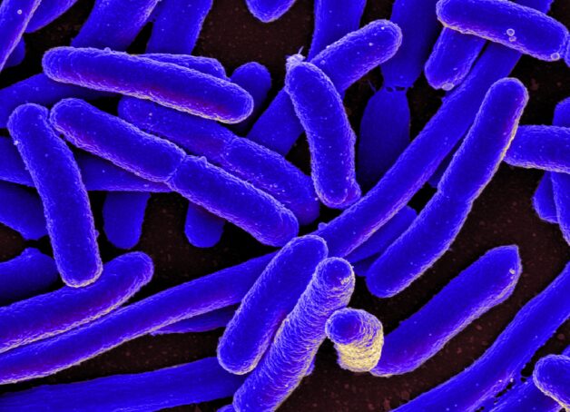 Vi khuẩn E coli có thể gây viêm phổi