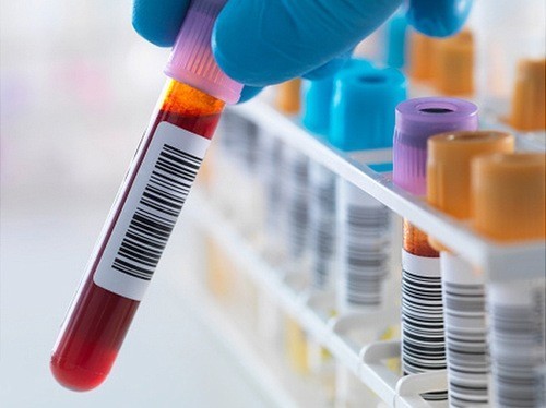 HIV là bệnh lý nguy hiểm cần được phát hiện sớm và điều trị hiệu quả
