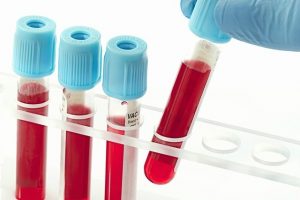 Xét nghiệm máu giúp chẩn đoán có thai sớm nhất