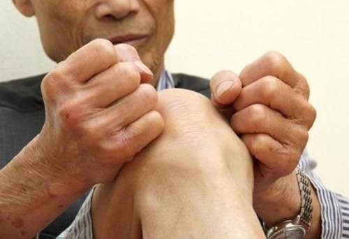 Bệnh phong thấp gây đau đớn hạn chế khả năng di chuyển cho người bệnh