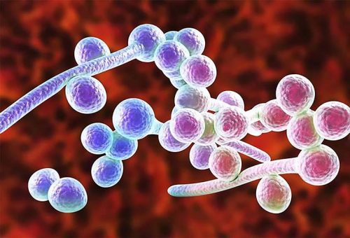 Ra nhiều huyết trắng có thể là dấu hiệu của nhiễm nấm Candida albicans