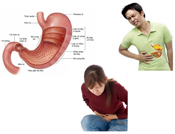 Nội soi dạ dày là thủ thuật bắt buộc trong thăm khám để phát hiện sớm và chính xác các bệnh lý bất thường tại dạ dày.