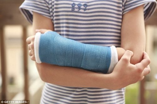 Xử trí thế nào khi trẻ bị gãy xương