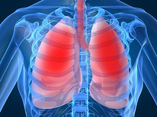 Viêm phổi thường do virus, vi khuẩn hoặc các sinh vật khác gây ra