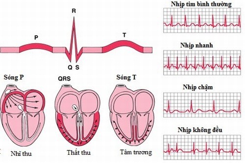 Các yếu tố nguy cơ