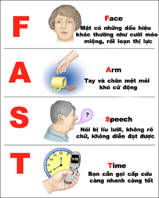 Ai dễ bị đột quỵ? nhận biết ngay các dấu hiệu sau đây