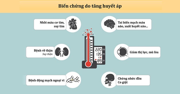 Ai dễ bị đột quỵ - Người mắc bệnh lý tim mạch, tăng huyết áp bị 
