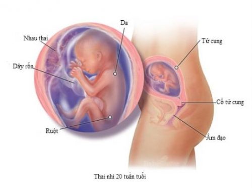 Hở eo tử cung là nguyên nhân hàng đầu gây sảy thai ở chị em