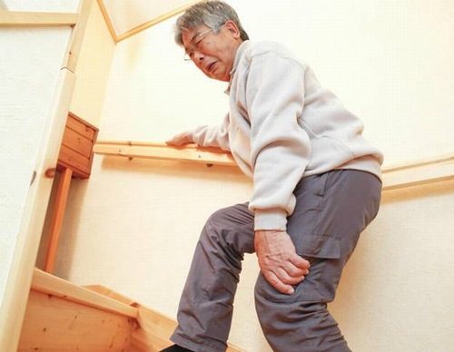 Bệnh Viêm Đa Cơ: Nguyên nhân, triệu chứng, chẩn đoán và cách điều trị 2 Bệnh Viêm Đa Cơ: Nguyên nhân, triệu chứng, chẩn đoán và cách điều trị 2