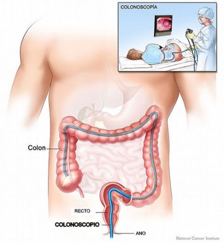Nội soi gây mê thường được áp dụng với dạ dày, thực quản, tá tràng và đại trực tràng.