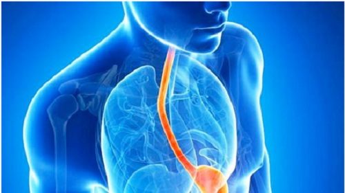 Biết cách phòng bệnh viêm thực quản là cần thiết để ngăn các tác hại nghiêm trọng