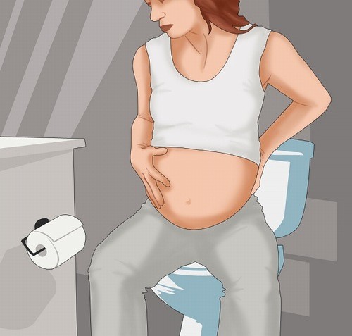 Trong giai đoạn mang thai phụ nữ dễ mắc bệnh trĩ