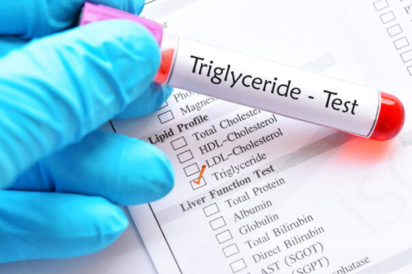 Chỉ số triglyceride