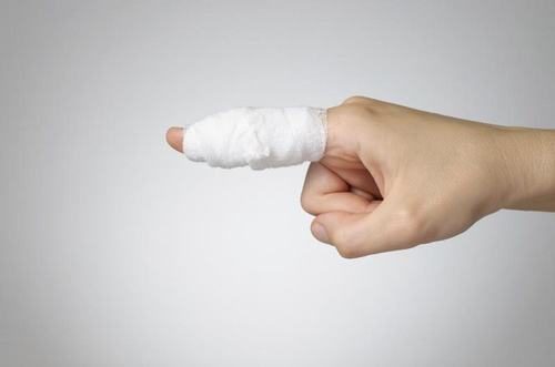 Gãy ngón tay là tình trạng xương ở ngón tay bị gãy hay vỡ ra ảnh hưởng đến chức năng cầm nắm của bàn tay