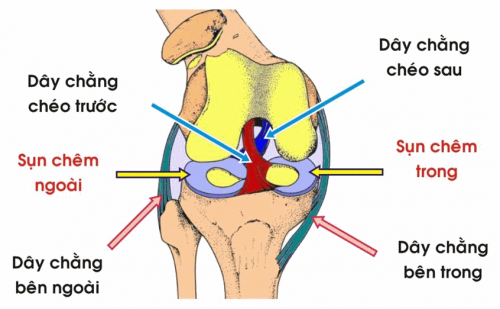 Phẫu thuật rách sụn chêm KHI NÀO cần BẮT BUỘC thực hiện? phau-thuat-rach-sun-chem-khi-nao-can-thuc-hien