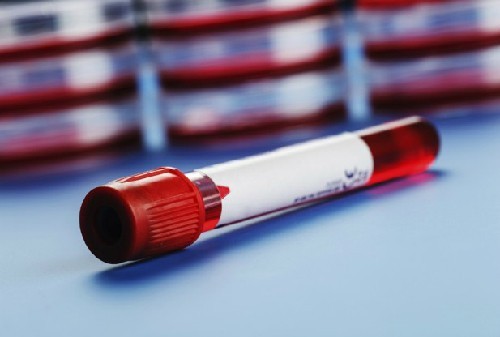 Tìm hiểu về xét nghiệm máu để biết có thai