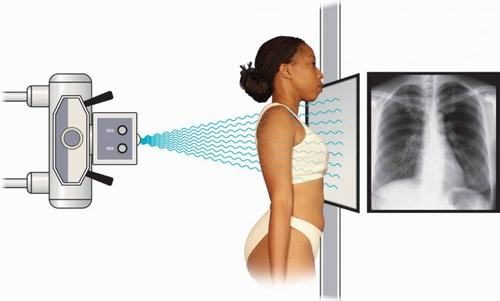 【GIẢI MÃ】Chụp X Quang Nhiều có HẠI không tới sức khỏe? 2 【GIẢI MÃ】Chụp X Quang Nhiều có HẠI không tới sức khỏe? 2