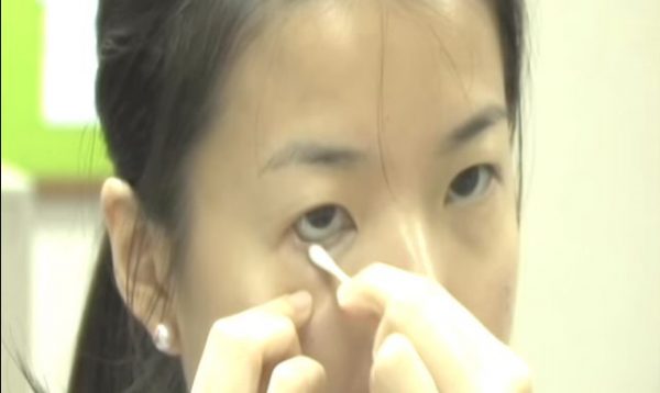 Dị vật giác mạc có thể gây ra những hậu quả nghiêm trọng nếu không được điều trị đúng cách