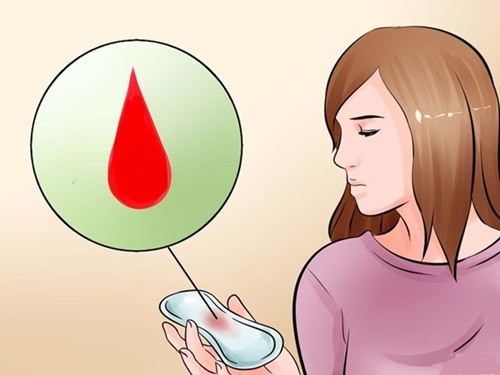 Kinh nguyệt ra nhiều máu đỏ tươi kèm những triệu chứng bất thường khác có thể là dấu hiệu của bệnh phụ khoa nguy hiểm