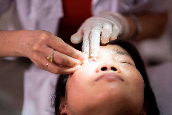 Nhiều bệnh lý có thể xảy ra ở mi mắt cần được điều trị sớm để tránh biến chứng.
