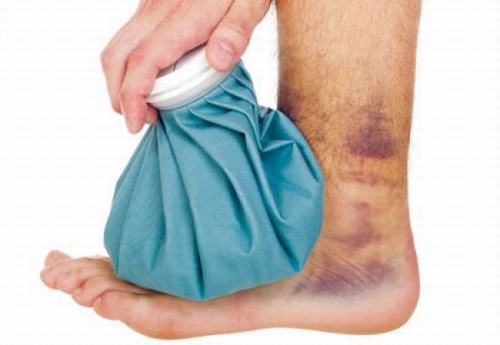 Những điều CẦN LÀM khi trật khớp mắt cá chân để Hồi Phục Nhanh 2 Những điều CẦN LÀM khi trật khớp mắt cá chân để Hồi Phục Nhanh 2