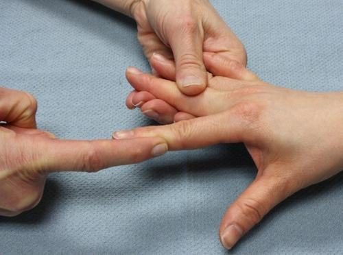 Khi có áp lực lên ngón tay như chấn thương, uốn mạnh ngón tay gây lệch quá mức có thể gây trật khớp