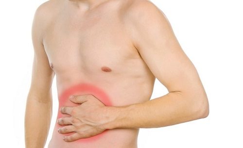 Triệu chứng Polyp đại tràng là một khối phát triển bất thường trên bề mặt ruột già