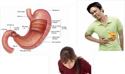 Cảm giác đau vùng bụng là triệu chứng thường gặp khi bị viêm loét dạ dày tá tràng