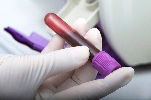 Xét nghiệm máu tìm dấu ấn ung thư CA 125 giúp chẩn đoán sớm ung thư buồng trứng