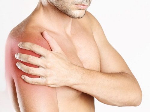 cách điều trị bong gân khớp vai