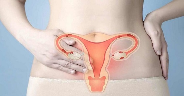 Niêm mạc tử cung mỏng là hiện tượng nhiều chị em gặp phải