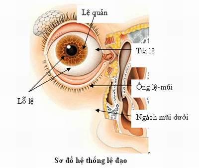 Chứng tắc lệ đạo (tắc tuyến lệ) gây tình trạng chảy nước mắt thường xuyên rất bất tiện. 