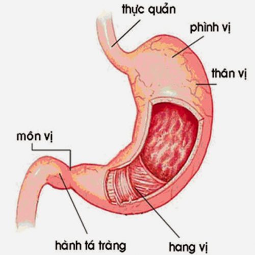 Viêm xung huyết hang vị dạ dày là tình trạng niêm mạc vùng hang vị dạ dày bị viêm loét, các mạch máu ở vùng viêm dãn nở