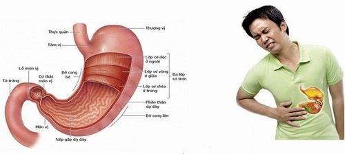 Viêm dạ dày cấp tính có nguy hiểm không là băn khoăn chung của nhiều người khi mắc bệnh.